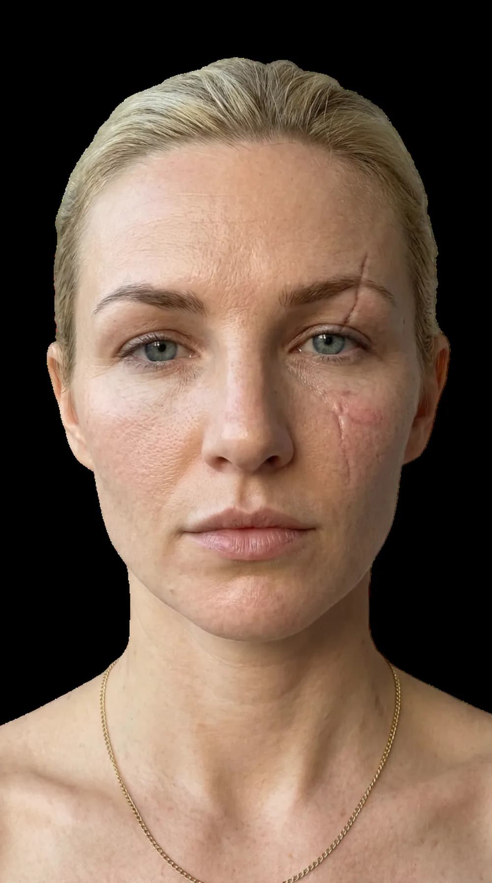 Volunteer source photo used for a GlowUp Face pore scan