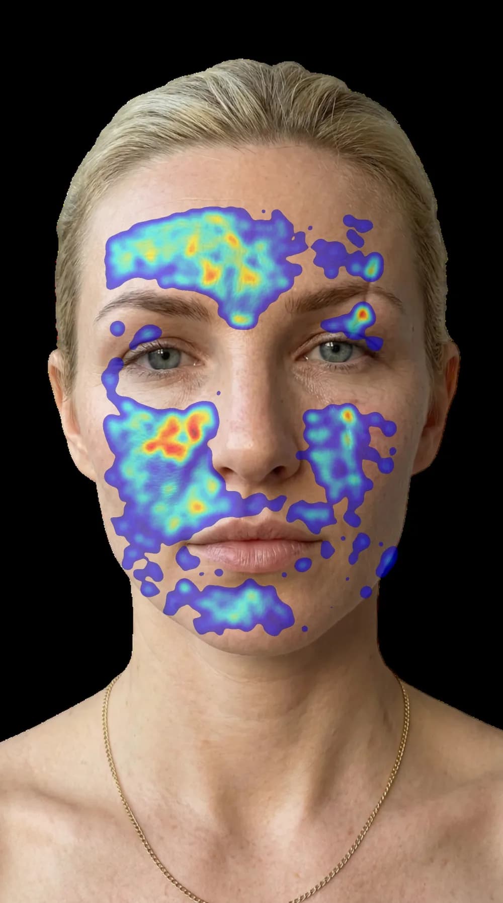 GlowUp Face pore-visibility heatmap for the same volunteer photo