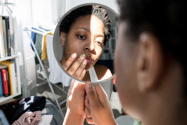 Unha verde após usar unhas postiças: o que fazer agora