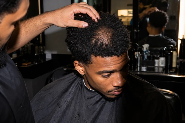 Hair Thinning at the Crown in Women: Causes and Treatment