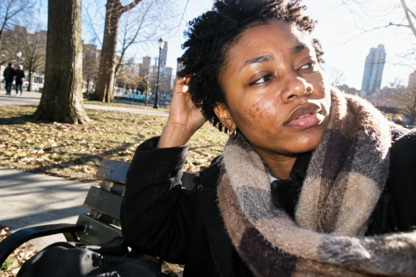 Acne cística: o que ajuda em casa e quando procurar um dermatologista