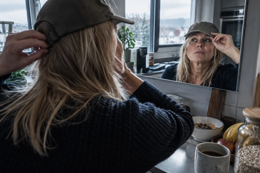 Does Wearing a Hat Cause Hair Loss? What Evidence Says
